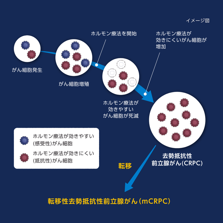 去勢抵抗性前立腺がんになるまでの経緯※