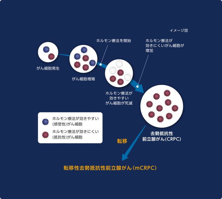 去勢抵抗性前立腺がんになるまでの経緯の図